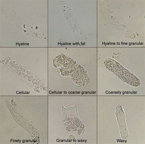 Cast compilation | eClinpath