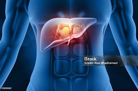 Human Liver Pain Liver Infection Stock Photo - Download Image Now - Alcohol - Drink, Alcohol ...