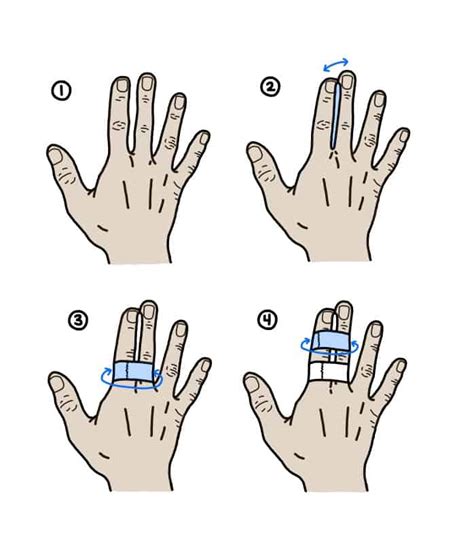 How to Buddy Tape a Sprained Finger: 4 Steps - Injury Health Blog