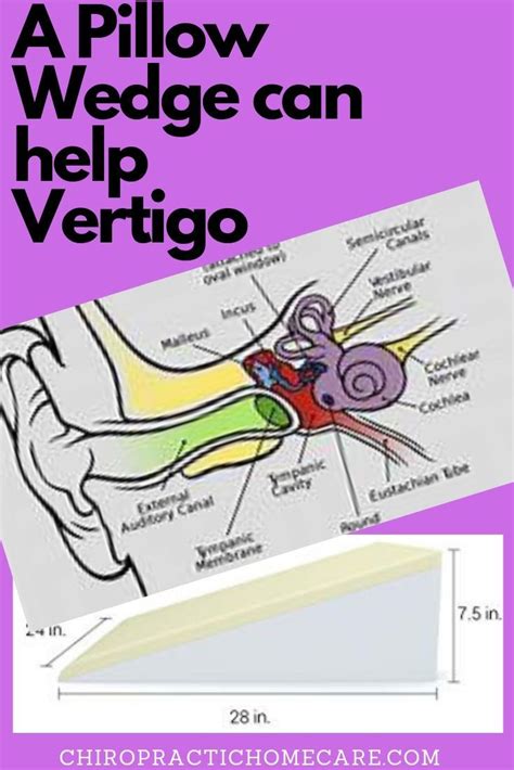 Pillow Wedge for Vertigo | Vertigo treatment, Vertigo, Vertigo relief