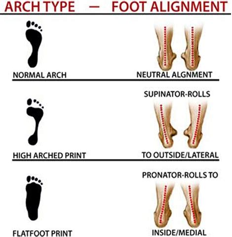 Custom Made Orthotics Insole: TOG GaitScan in Newbury, Thatcham