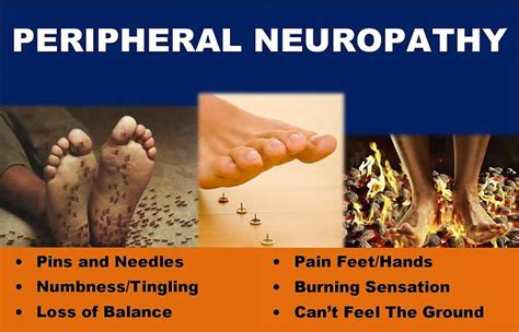 The Ultimate Peripheral Neuropathy Relief Guide