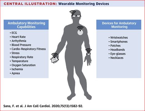 Ambulatory Electrocardiography