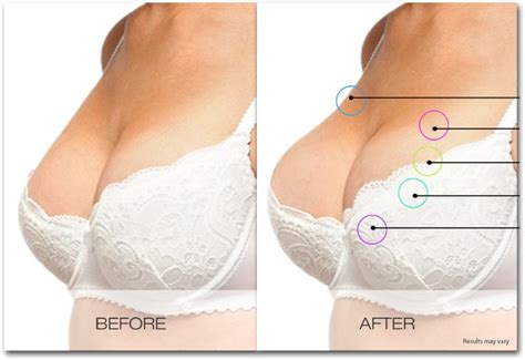 Get a bigger bust and increase breast size without surgery with BOLERO ...