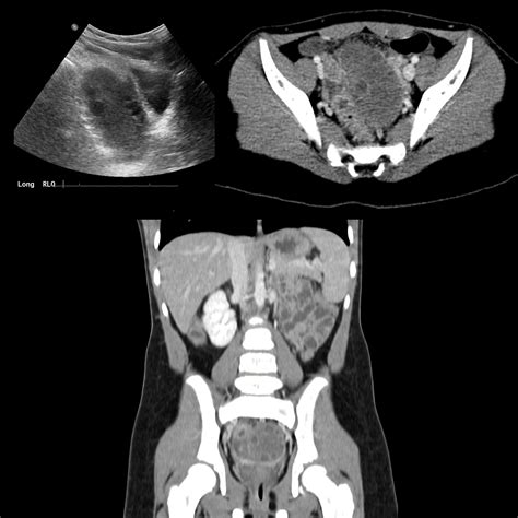 School ager with diffuse abdominal pain | Pediatric Radiology Case | Pediatric Imaging ...