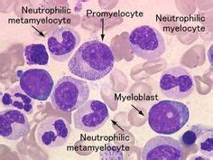 myelocyte metamyelocyte - Google Search | Medical technology ...