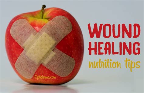 Wound Management And Nutrition For Optimal Wound Heal - vrogue.co