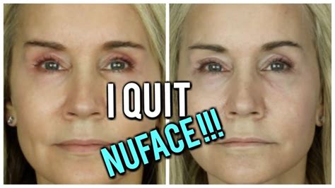 Nuface Body Before And After - New Product Product reviews, Discounts ...