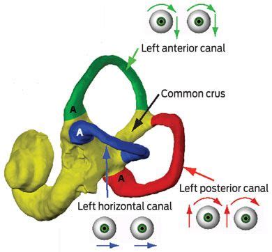 Anterior Bppv Epley Maneuver | The left inner ear, showing nystagmus ...