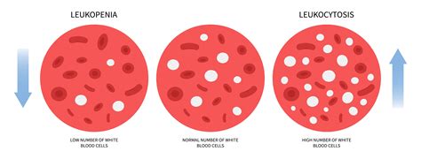 Is a high White Blood Cell Count (WBC) during pregnancy harmful?