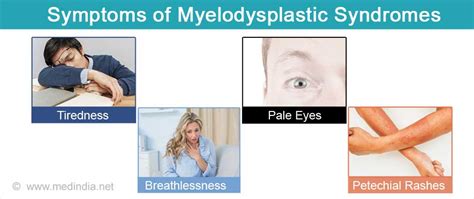 Myelodysplastic Syndrome - Types, Causes, Symptoms, Diagnosis ...