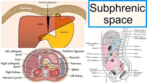 subphrenic space - YouTube