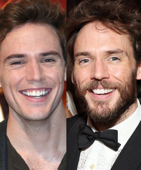 Did Sam Claflin Get Veneers? Here Are 14 Celebrities Before And After Veneers | Evie Magazine