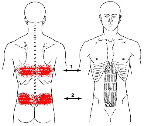 What Causes A Wide Band Of Pain In Your Back | SIMPLE BACK PAIN RELIEF | SimpleBackPainRelief.com