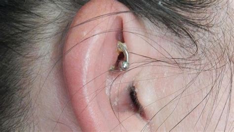 How To Cure A Piercing Infection - Contestgold8