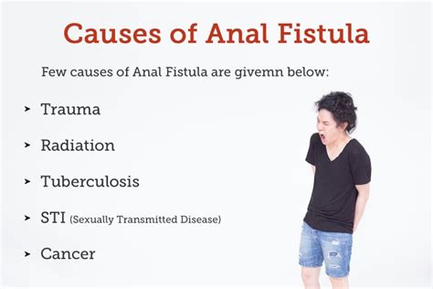 Anal Fistula Causes Symptoms And Treatment | My XXX Hot Girl