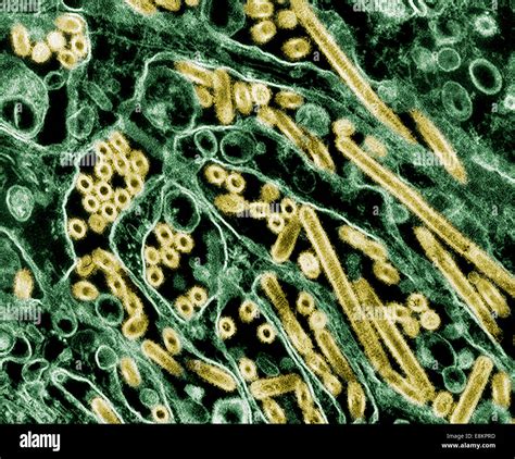 Colorized transmission electron micrograph of Avian influenza H5N1 ...