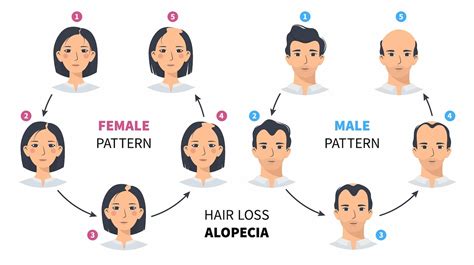 Medical Causes of Hair Loss: Who to See and What to Do