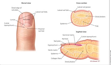 Acute and Chronic Paronychia | AAFP