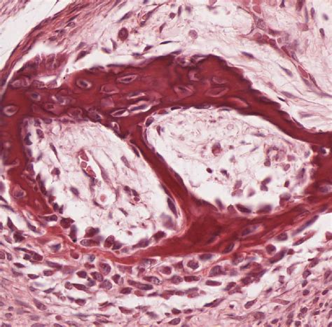 Bone and Bone Formation | histology