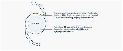 AcrySof IQ PanOptix Trifocal IOL | Lens Option for Cataract Patients | MyAlcon | Egypt