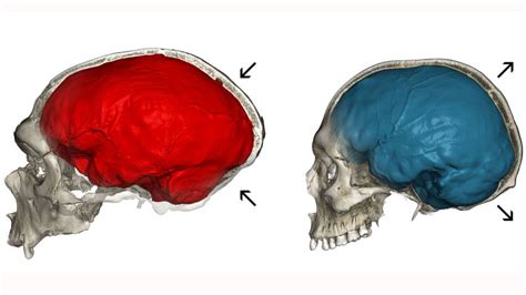 Neanderthal genes could explain the shape of our skulls, study finds | CNN