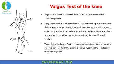 Valgus Stress Test Of The Knee | OrthoFixar 2024