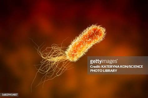 Sepsis And Urinary Tract Infection Photos et images de collection - Getty Images