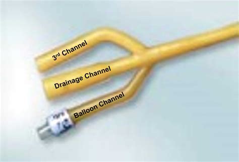 Indwelling Urinary Catheter-related Problems