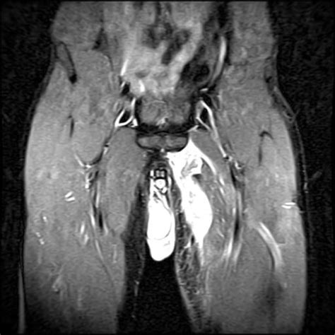 OrthoDx: Groin Pain in Hockey Player - Clinical Advisor