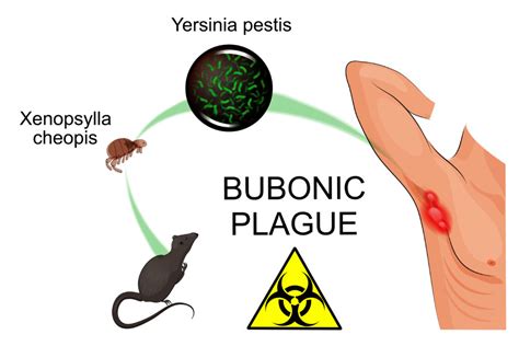 Pathogen of the Month: Yersinia Pestis - GIDEON - Global Infectious ...