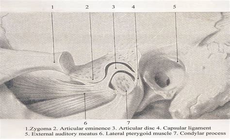 Temporomandibular Joint Arthroscopy versus Arthrotomy | IntechOpen