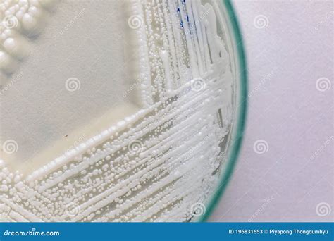 Yeast in Petri Dish for Education in Laboratories. Stock Image - Image ...