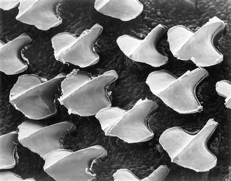 Dogfish (shark) Skin With Denticles Photograph by Dennis Kunkel Microscopy/science Photo Library ...
