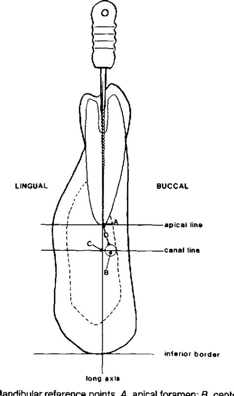 Figure 2 from Anatomical relationship of the mandibular canal to its ...