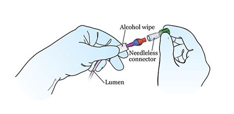 Picc Catheter