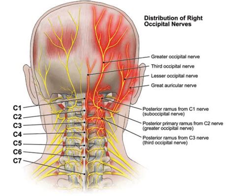 ...but maybe tomorrow: occipital nerve decompression surgery tomorrow!