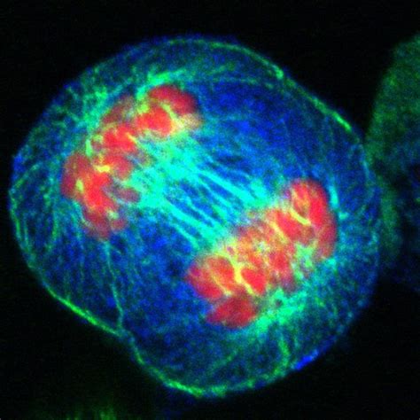 Human cell in anaphase | Wellcome Collection