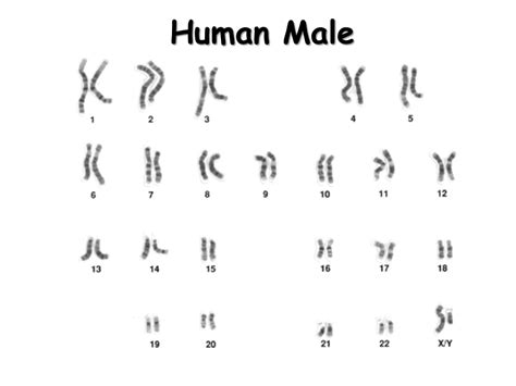 Karyotypes - Presentation Biology