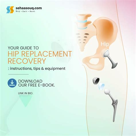 Hip Replacement Recovery- Tips And More | by Sehaasouq | Medium