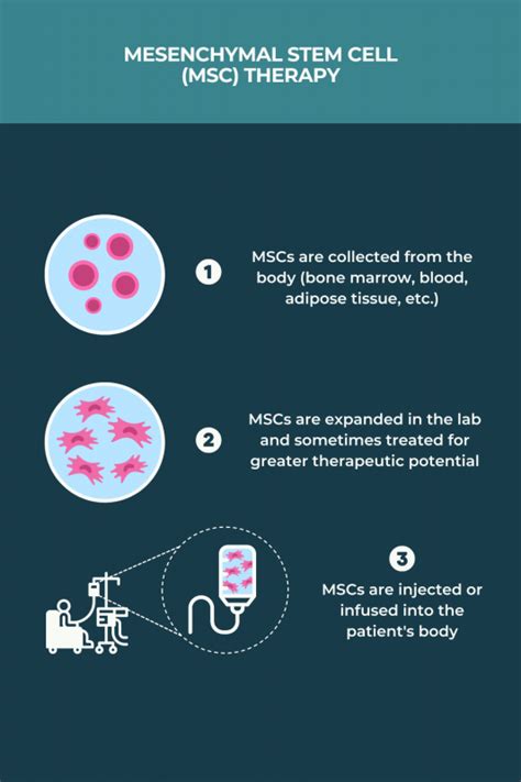 Stem cell therapy and MS | Multiple Sclerosis News Today