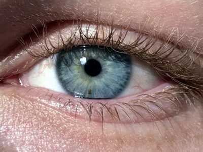 Pinpoint pupils: 8 Causes, 5 Symptoms & 5 Treatments