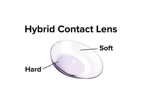 Contact Lens Types | Ohio State Medical Center