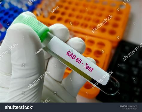 Blood Sample Gad 65 Glutamate Decarboxylase Stock Photo 2155878615 | Shutterstock