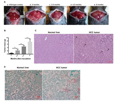 An Oncogenic Hepatocyte-Induced Orthotopic Mouse Model of Hepatocellular Cancer Arising in the ...