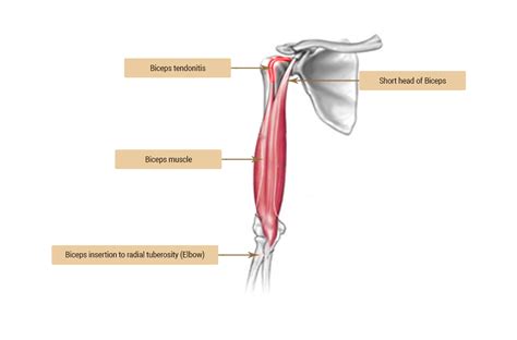 Radial Tuberosity Biceps