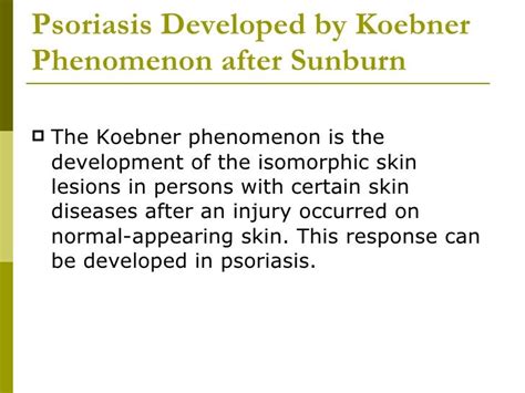 Psoriasis Developed By Koebner Phenomenon After Radiation Therapy