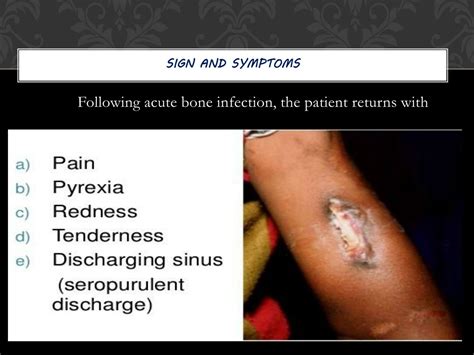 PPT - Chronic osteomyelitis PowerPoint Presentation, free download - ID:8849279