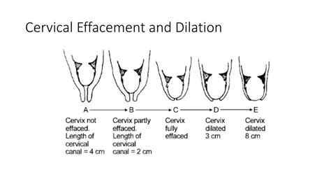 PPT - Stages of Labor and Delivery PowerPoint Presentation, free download - ID:2125208