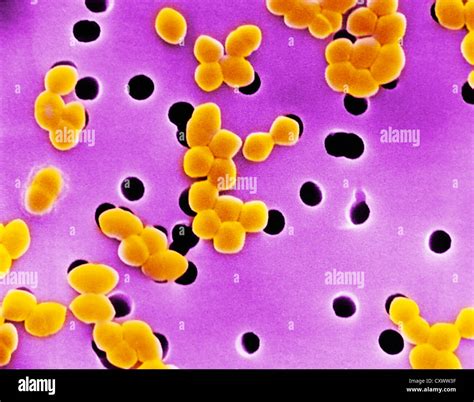 Enterococcus Gram Stain